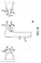 Fig. 04 - Sterile de-molding apparatus and method