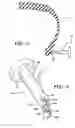 Fig. 03 - Bead construction method for a tire