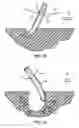 Fig. 10 - Arcuate aeration tine