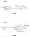 Fig. 11 - Arcuate aeration tine