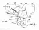 Fig. 32 - Residual magnetic devices and methods