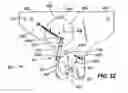 Fig. 32 - Residual magnetic devices and methods