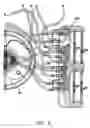 Fig. 09 - Method and apparatus for blood separations