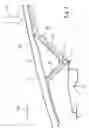 Fig. 03 - Front hood system