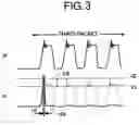 Fig. 04 - Circuit for varying gain of preamplifier