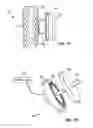 Fig. 13 - Residual magnetic devices and methods