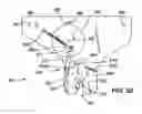 Fig. 32 - Residual magnetic devices and methods