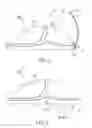 Fig. 04 - Storage device for a cleaning cloth