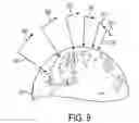 Fig. 09 - System for interactive 3D navigation for proximal object inspection