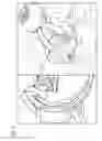 Fig. 03 - Method for representing preoperatively recorded three-dimensional image data when recording two-dimensional X-ray images