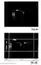 Fig. 03 - Method for detecting objects in a digital image using image zones of different resolutions