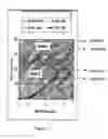 Fig. 12 - Optimal IOL shape factors for human eyes
