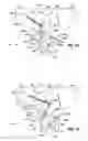 Fig. 31 - Residual magnetic devices and methods