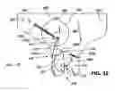 Fig. 32 - Residual magnetic devices and methods