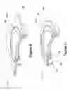 Fig. 06 - Recessed light fixture