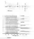 Fig. 09 - Method and apparatus for envelope detection and enhancement of pitch cue of audio signals