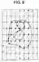 Fig. 07 - Method and system for automatically segmenting organs from three dimensional computed tomography images
