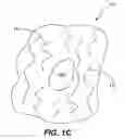 Fig. 04 - Image analysis of the golgi complex