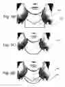 Fig. 11 - Method and system for enhancing portrait images that are processed in a batch mode