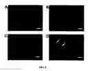 Fig. 09 - Constructs binding to phosphatidylserine and their use in disease treatment