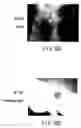 Fig. 08 - Agent for therapy or treatment of wound