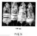Fig. 09 - Agent for therapy or treatment of wound