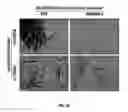 Fig. 05 - Active specific immunotherapy of cancer metastasis