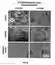 Fig. 07 - Active specific immunotherapy of cancer metastasis