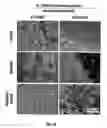 Fig. 08 - Active specific immunotherapy of cancer metastasis