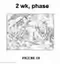 Fig. 03 - Isolated/cloned human NT2 cell lines expressing serotonin and GABA