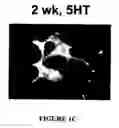 Fig. 04 - Isolated/cloned human NT2 cell lines expressing serotonin and GABA
