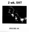 Fig. 05 - Isolated/cloned human NT2 cell lines expressing serotonin and GABA