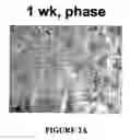 Fig. 06 - Isolated/cloned human NT2 cell lines expressing serotonin and GABA