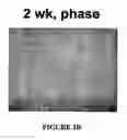 Fig. 07 - Isolated/cloned human NT2 cell lines expressing serotonin and GABA