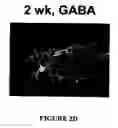 Fig. 09 - Isolated/cloned human NT2 cell lines expressing serotonin and GABA