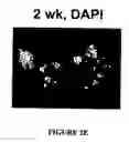Fig. 10 - Isolated/cloned human NT2 cell lines expressing serotonin and GABA