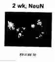 Fig. 11 - Isolated/cloned human NT2 cell lines expressing serotonin and GABA