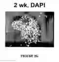 Fig. 12 - Isolated/cloned human NT2 cell lines expressing serotonin and GABA