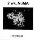 Fig. 13 - Isolated/cloned human NT2 cell lines expressing serotonin and GABA