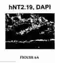 Fig. 23 - Isolated/cloned human NT2 cell lines expressing serotonin and GABA