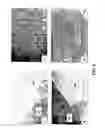 Fig. 07 - Methods of preparing transplantable product for treatment of skin defects