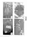 Fig. 09 - Methods of preparing transplantable product for treatment of skin defects