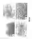 Fig. 11 - Methods of preparing transplantable product for treatment of skin defects