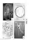Fig. 12 - Methods of preparing transplantable product for treatment of skin defects