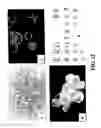 Fig. 13 - Methods of preparing transplantable product for treatment of skin defects