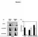 Fig. 02 - TRAIL and methods of modulating T cell activity and adaptive immune responses using TRAIL