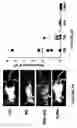 Fig. 07 - Compositions and methods for treatment of hypertrophic tissues