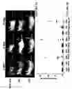 Fig. 08 - Compositions and methods for treatment of hypertrophic tissues