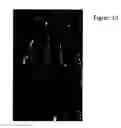 Fig. 16 - Compositions and methods for treatment of hypertrophic tissues