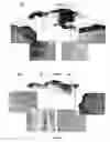 Fig. 08 - Methods for modulating topical inflammatory response